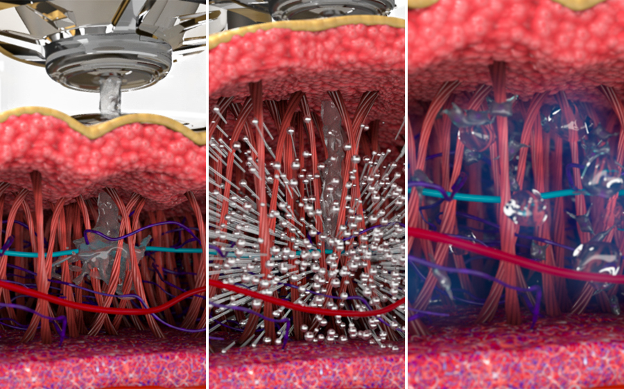 How EnerJet2.0 Kinetic Lift Works