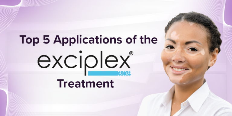 Top 5 Applications of the Exciplex® Treatment