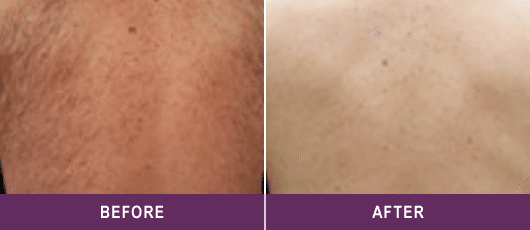 HEALTHY-LOOKING, RADIANT SKIN
