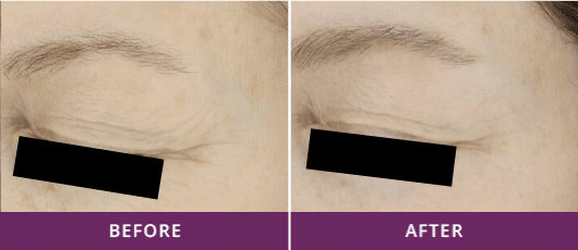 ENHANCED SKIN TONE