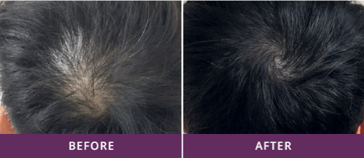 NATURAL HAIR REVIVAL