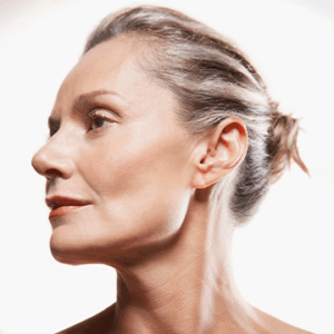 Alma Harmony - Model