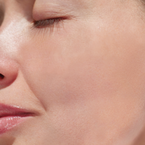 Frezyderm Sensitive Red Skin is for people with rosacea, exclusively distributed by SpectruMed in the Philippines
