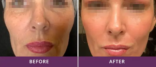 CUSTOM DOWNTIME OPTIONS