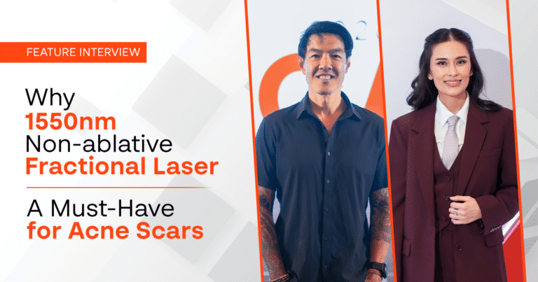 Why 1550nm Non-ablative Fractional Laser is a Must-have for Acne Scars