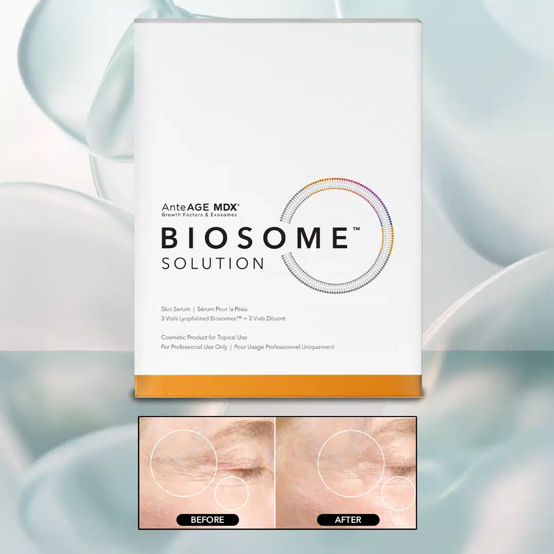 Biosomes Box Image (with B&A)