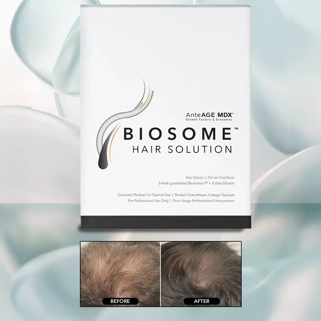 Biosomes Hair Solution Box Image (w B&A)