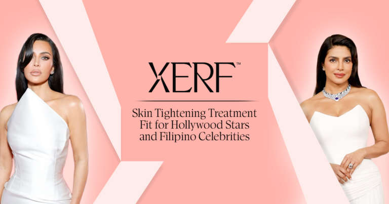 XERF: Skin Tightening Treatment Fit for Hollywood Stars and Filipino Celebrities