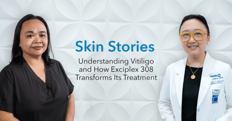 Skin Stories: Understanding Vitiligo and How Exciplex 308 Transforms Its Treatment