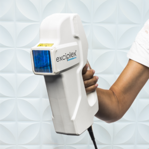 Exciplex Transforms Vitiligo Treatment