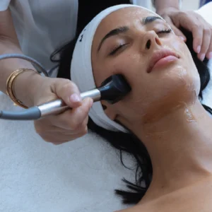 OptimasMAX for Hair Removal & Vascular Treatment