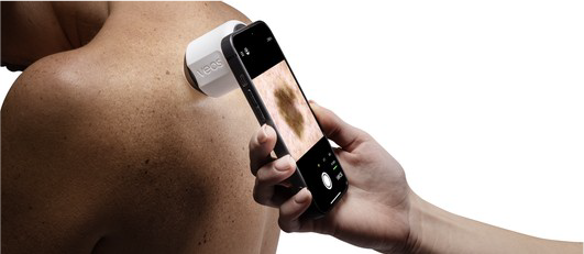 SKIN LESION EXAMINATION 