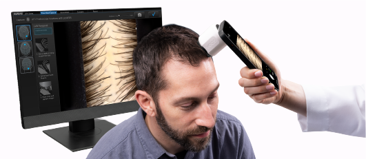 HAIR & SCALP ANALYSIS