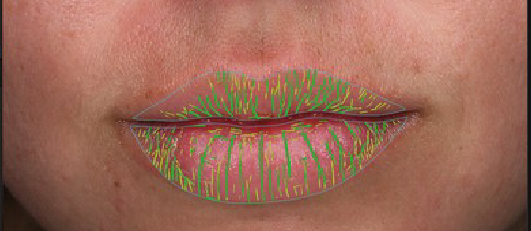 ASSESS LIPS & PERIORAL AREA