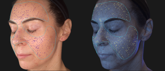 MONITOR FACIAL FEATURES